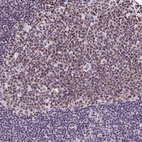 Anti-TRA2B Antibody