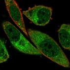 Anti-ABCA13 Antibody