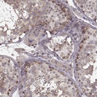 Anti-SLAIN2 Antibody