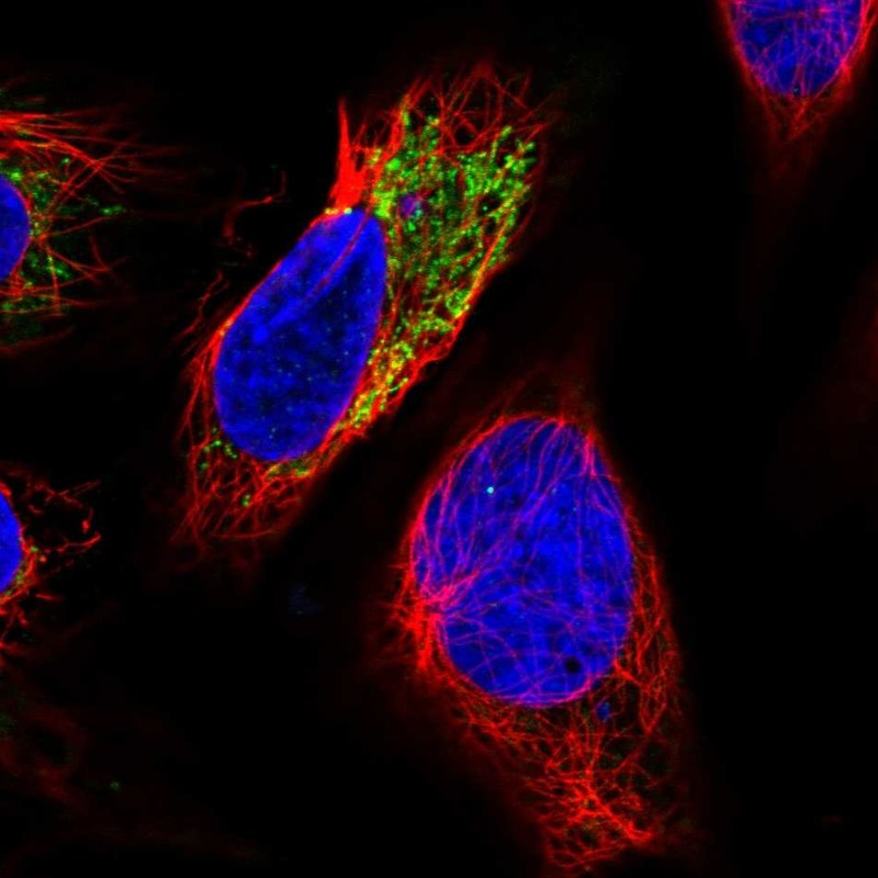 Anti-PHYKPL Antibody