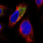 Anti-PHYKPL Antibody