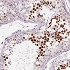 Immunohistochemical staining of human testis shows high expression.