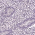 Immunohistochemical staining of human endometrium shows low expression as expected.