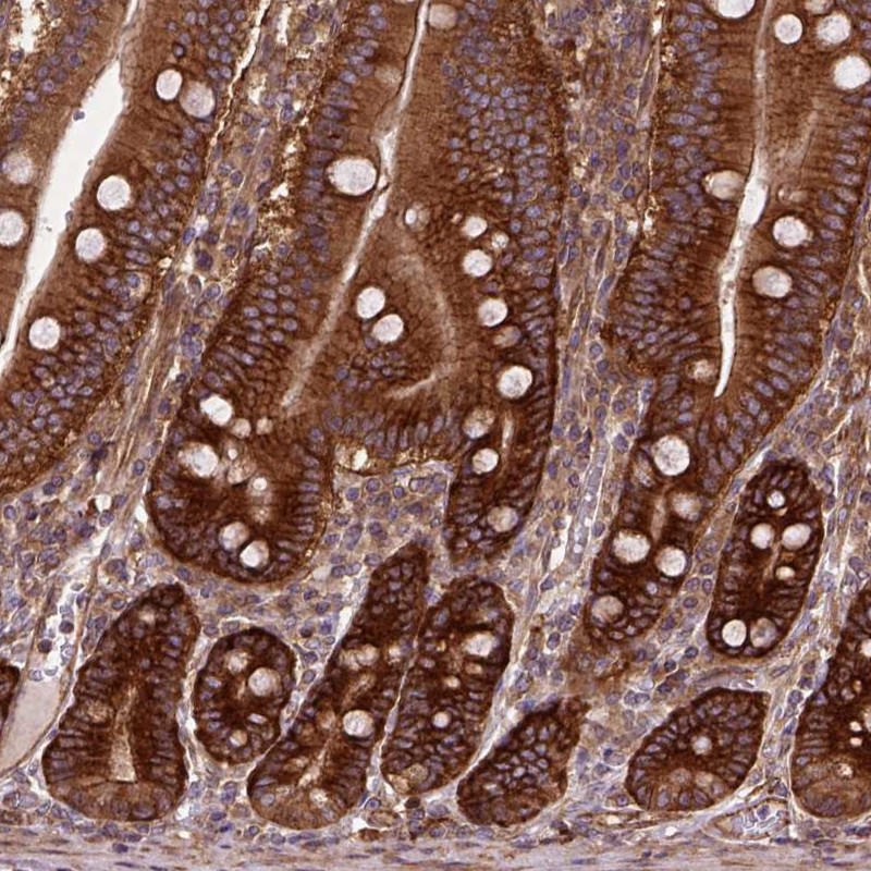 Anti-CAPRIN1 Antibody