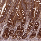 Anti-CAPRIN1 Antibody