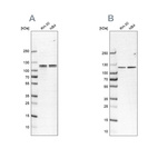 Western blot analysis using Anti-CAPRIN1 antibody HPA063617 (A) shows similar pattern to independent antibody HPA018126 (B).