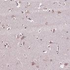 Anti-CPT1C Antibody