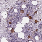 Anti-MS4A13 Antibody