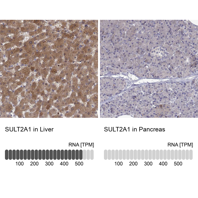 Anti-SULT2A1 Antibody