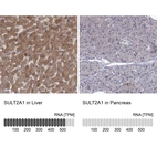 Anti-SULT2A1 Antibody
