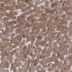 Anti-SULT2A1 Antibody
