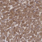 Immunohistochemical staining of human liver shows high expression.