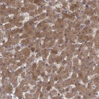 Immunohistochemical staining of human liver shows high expression.