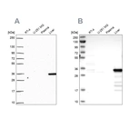 Western blot analysis using Anti-SULT2A1 antibody HPA063633 (A) shows similar pattern to independent antibody HPA041487 (B).
