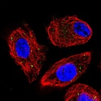 Anti-CLCN4 Antibody