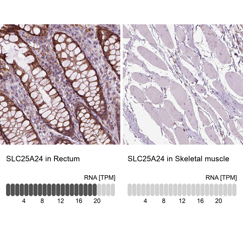 Anti-SLC25A24 Antibody