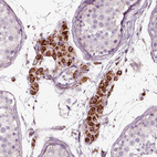 Immunohistochemical staining of human testis shows strong positivity in cytoplasm granular in Leydig cells.
