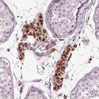 Immunohistochemical staining of human testis shows strong positivity in cytoplasm granular in Leydig cells.
