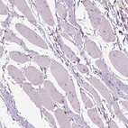 Immunohistochemical staining of human skeletal muscle shows negative positivity in neuronal processes in myocytes.