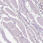 Immunohistochemical staining of human skeletal muscle shows negative positivity in neuronal processes in myocytes.