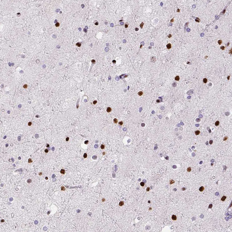 Anti-ZEB1 Antibody