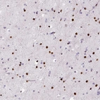 Anti-ZEB1 Antibody