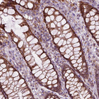 Immunohistochemical staining of human rectum shows strong positivity in cytoplasm granular in glandular cells.