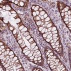 Immunohistochemical staining of human rectum shows strong positivity in cytoplasm granular in glandular cells.