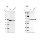 Western blot analysis using Anti-SLC25A24 antibody HPA063636 (A) shows similar pattern to independent antibody HPA028519 (B).