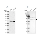 Western blot analysis using Anti-SLC25A24 antibody HPA063636 (A) shows similar pattern to independent antibody HPA028519 (B).