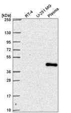 Anti-SUPT7L Antibody