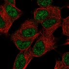 Immunofluorescent staining of human cell line SH-SY5Y shows localization to nucleoplasm.