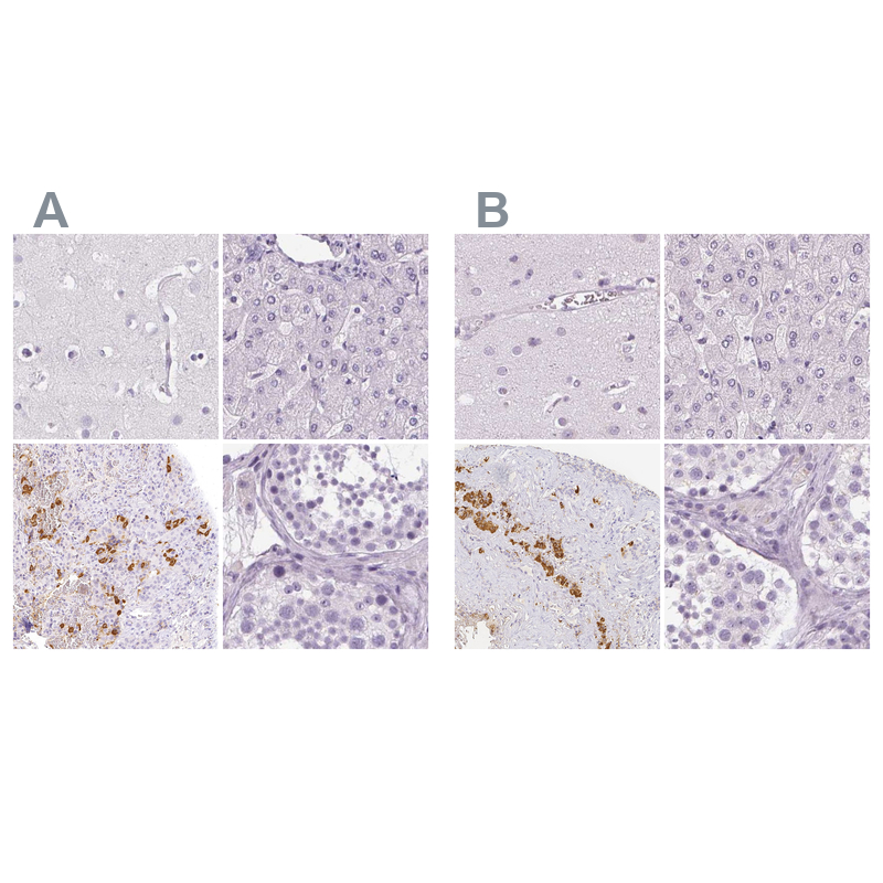 Anti-POMC Antibody