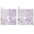 Anti-POMC Antibody