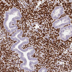 Immunohistochemical staining of human endometrium shows strong nuclear positivity in stromal cells.