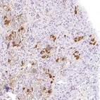 Immunohistochemical staining of human pituitary gland using Anti-POMC antibody HPA063644.