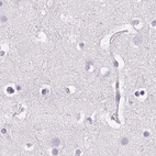 Immunohistochemical staining of human cerebral cortex using Anti-POMC antibody HPA063644.