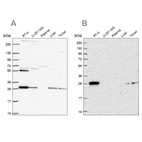 Western blot analysis using Anti-PMM2 antibody HPA063649 (A) shows similar pattern to independent antibody HPA040852 (B).