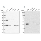 Western blot analysis using Anti-PMM2 antibody HPA063649 (A) shows similar pattern to independent antibody HPA040852 (B).