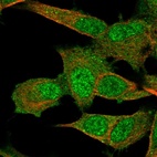 Immunofluorescent staining of human cell line SH-SY5Y shows localization to nucleus & cytosol.