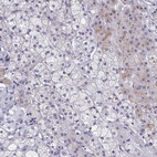 Anti-SYT2 Antibody