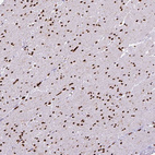 Immunohistochemical staining of human smooth muscle shows strong nuclear positivity in smooth muscle cells.