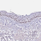 Anti-PAX3 Antibody