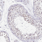 Immunohistochemical staining of human testis shows moderate positivity in nucleoli in cells in seminiferous ducts.