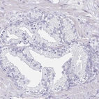 Immunohistochemical staining of human prostate shows no positivity in nucleoli in glandular cells as expected.