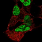 Immunofluorescent staining of human cell line SK-MEL-30 shows localization to nucleoplasm.