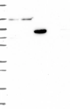 Lane 1: Marker [kDa] 250, 130, 95, 72, 55, 36, 28, 17, 10 | Lane 2: RT4 | Lane 3: U-251 MG | Lane 4: Human Plasma | Lane 5: Liver | Lane 6: Tonsil