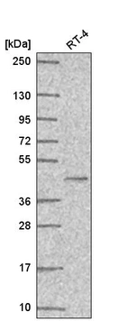 Western blot analysis in human cell line RT-4.