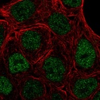 Immunofluorescent staining of human cell line RT4 shows localization to nucleus.