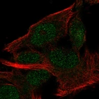 Anti-MINDY2 Antibody